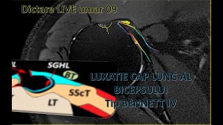 dictare live umar 09 ro [upl. by Stephenie]