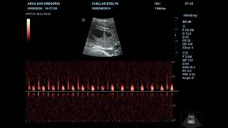 FRECUENCIA CARDIACA DE EMBRION EVELYN CUELLAR [upl. by Haek]