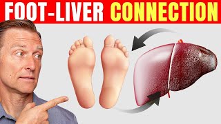 How to Use Your Feet to Diagnose Liver Problems—Dr Berg Explains [upl. by Elohcan]