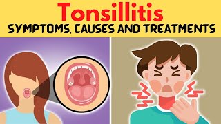 Tonsillitis Symptoms Causes and Treatments [upl. by Harimas425]