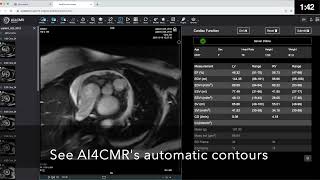 AI4CMR  AI for Medical Imaging [upl. by Houlberg702]