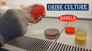 Urine Culture Test Bangla [upl. by Chemaram620]