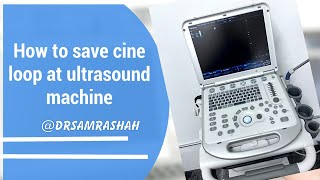 How to save cine loop image at mindray ultrasound machine [upl. by Jobyna711]