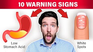 10 Warning Signs ALL Vegans Ignore [upl. by Socha782]