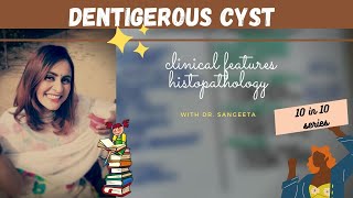 dentigerous cyst lecture I dental lectures [upl. by Sartin177]