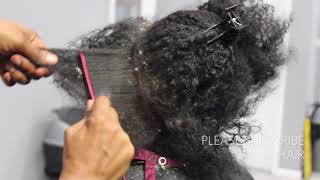 Picking BIG scalp flakes Psoriasis and Dermatitis SEW IN WEAVE REMOVAL [upl. by Drazze]