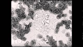 Leucocyten  Phagosytose [upl. by Eileme]