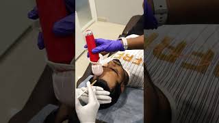 Hair FallGrowth Treatment in Coimbatore coimbatore covai haircare hairlosstreatment [upl. by Cope]