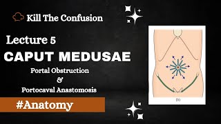 Caput Medusae  Portal Obstruction  Portocaval Anastomosis  Umbilicus  Abdomen Anatomy  KTC [upl. by Bovill226]