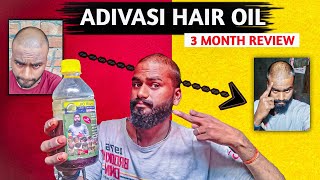 ✅ Adivasi hair oil 3month review 😱 and expose 😱 [upl. by Sawyer]