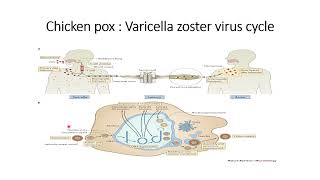 Chicken Pox Varicella Zoster Virus Cycle Code 170 [upl. by Brunell]