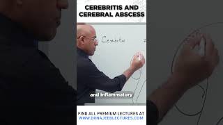 Cerebritis And Cerebral Abscess drnajeeb drnajeeblectures shortvideostatus [upl. by Evita]