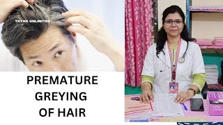 Cuase Of Premature Greying Of Hair And Homoeopathic Treatment😊😊 [upl. by Pattani214]