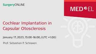 Cochlear Implantation in Capsular Otosclerosis  SurgeryONLINE [upl. by Nnyltiak]