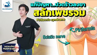 ปวดร้าวลงขา สลักเพชรจมPiriformis syndrome ฟิตได้ง่ายๆ ทำได้ที่บ้าน หมอชวนฟิต [upl. by Niki]