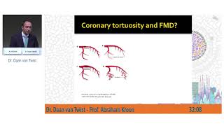 Unifocal and multifocal FMD Two different disease entities in a single patient [upl. by Huberto210]