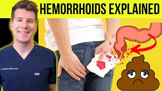 Doctor explains HEMORRHOIDS aka piles  Causes symptoms treatment amp prevention [upl. by Adara]