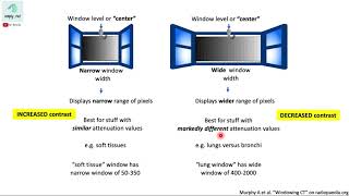 Window width and window level CT  simplified [upl. by Ytteb]