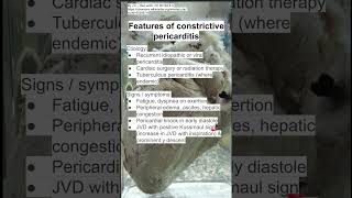 Features of constrictive pericarditis [upl. by Newell577]