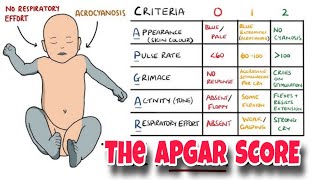 HOW TO CHECK APGAR SCORE 🐥 in Newborn Baby [upl. by Sorenson522]