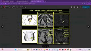 RADIOLOGY EXAM CASES [upl. by Eiznyl]