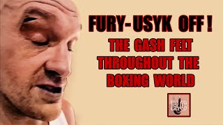 Tyson Fury vs Oleksandr Usyk Postponed  Quick Thoughts on the Cut [upl. by Nerrol231]