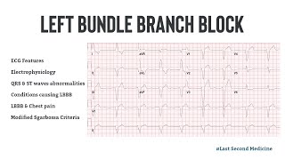 Left Bundle Branch Block  ECG Features Electrophysiology Causes amp Differential Diagnosis [upl. by Rabbi497]