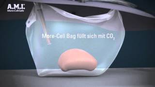 InBag Morcellation  MoreCellSafe von AMI  3D Animationsvideo [upl. by Doley]