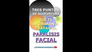 TRATE la PARALISIS FACIAL con estos TRES 3 Maravillosos puntos de acupuntura fisioterapia [upl. by Annaer]