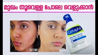 മുഖം തൂവെള്ള പോലെ വെളുക്കാൻ  Cetaphil Oily Skin Cleanser Malayalam Review [upl. by Enneite]