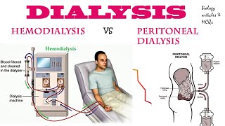 Dialysis  Hemodialysis  Peritoneal dialysis  BIOLOGY ARTICLES AND MCQS [upl. by Edahc]