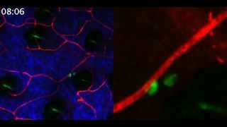 Visualisation of Skin Cells  ILC2 [upl. by Annawahs404]