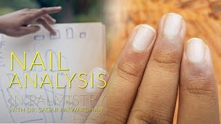 Learn Palmistry  Identifying Different Types of Nails and their Meaning 912 [upl. by Jun]