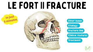 Le Fort II Fracture  Made easy in 5 Minutes  Medinare [upl. by Neerehs]