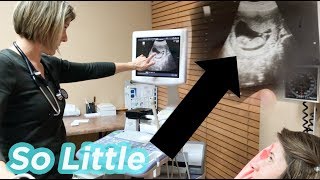 12 Week Ultrasound Surprise  Our baby waved at us [upl. by Rellim]