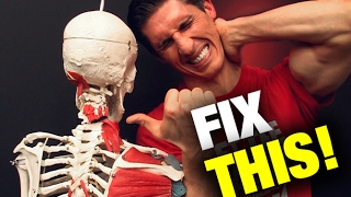 How to Fix a Stiff Neck in Seconds THIS WORKS [upl. by Hafler]