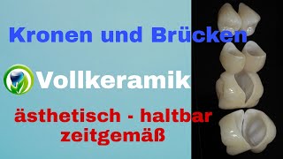 Kronen und Brücken Teilkronen  Vollkeramik  Zirkon Lithiumdisilikat [upl. by Jillian106]