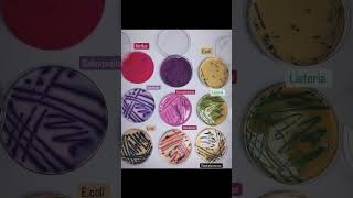 Gram Positive nd Negative Bacteria urineanalysis clinicalpathology microbiologylab ytshortsvideo [upl. by Shanney]