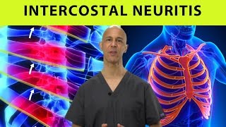 Intercostal Neuritis Relief Mid Back Pain Rib amp Chest Pain  Dr Mandell [upl. by Atinor827]