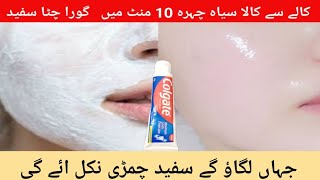 Colgate and Vaseline Face Pack for Face Whitening  10 minute mea Rang Gora Karne Ka Tarika [upl. by Hartnett]