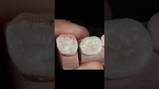 Maquillaje Disilicato de Litio aidite dientes esteticadental [upl. by Aiclef]