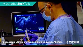 How It Works Endoscopic UltrasoundGuided Radiofrequency Ablation EUSRA [upl. by Hanus]