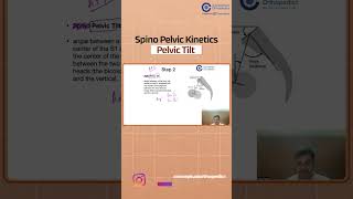 Spino Pelvic Kinetics Pelvic Tilt by Dr Vishal M Huggi  Orthopedics Residency [upl. by Shandie]