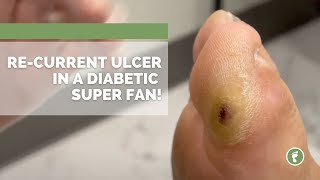 Ulcer on our Youtube Super Fan [upl. by Kirstin]