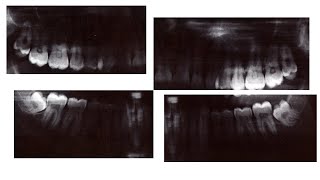 Imagerie Radiologique en Médecine Dentaire [upl. by Tryck]