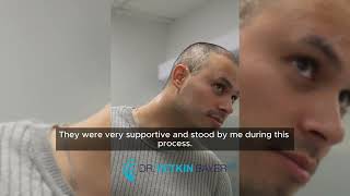 The Hair Transplant Miracle with Dr Yetkin Bayer Okans Hair Transplant Journey [upl. by Noryv]