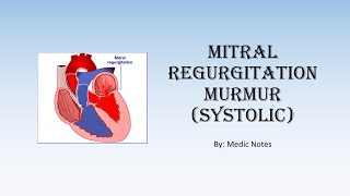 Mitral regurgitation murmur systolic  description causes pathophysiology sign value [upl. by Rhines]