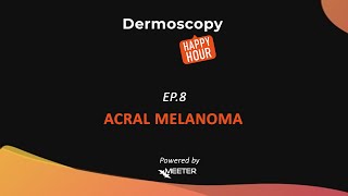 Dermoscopy Happy Hour  SEASON 2 EPISODE 8 quotACRAL MELANOMAquot [upl. by Lela233]