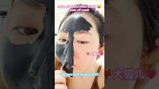 blackwhite heads removal！ blackheadsremoval 黑头粉刺 黑头粉刺说拜拜 beauty 分享好物 日常vlog 测评 [upl. by Gustin]