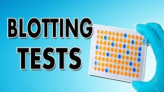 Blotting Techniques Western Blot Southern Blot and Northern Blot [upl. by Retnuh719]